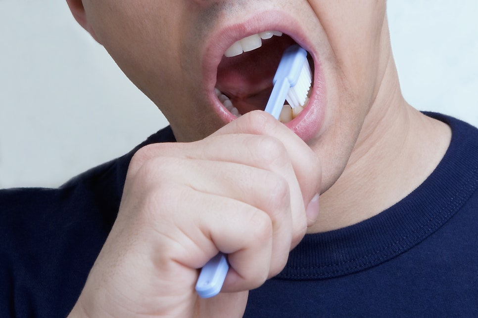 정자동 치아변색 예방방법이?