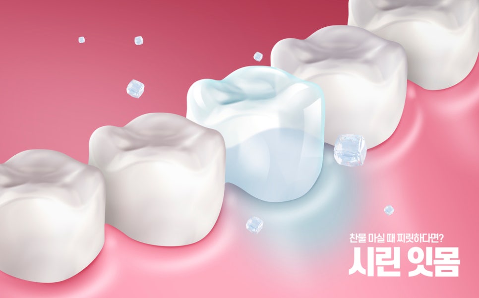 정자동 시린이, 여름철 차가운 음식이 유발할 수 있는 치아문제