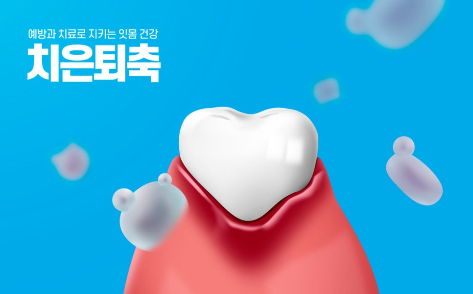 정자동 잇몸통증, 이가 아니라 잇몸이 아파요.