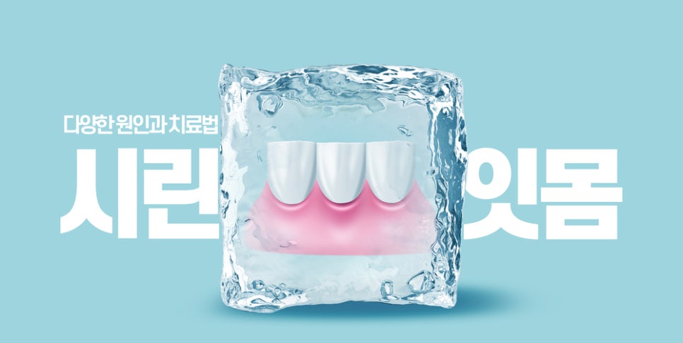 정자동 시린잇몸, 양치할 때 잇몸이 시리다면?