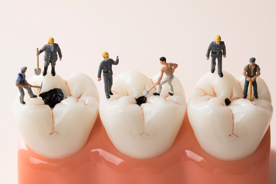 정자역치과, 치과 의사에게 직접 묻는 치과 상식 YES or NO