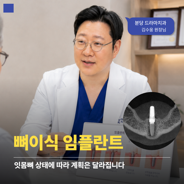 정자역치과 임플란트에서 ‘심는 것’보다 먼저 보는 게 있습니다
