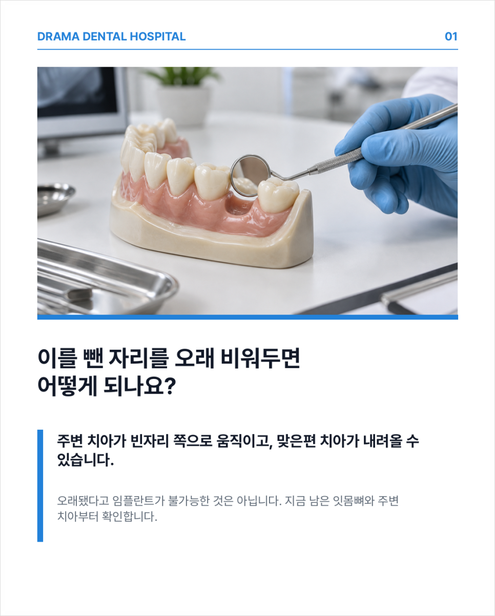 분당임플란트, 빠진 이를 오래 두면 나중에 심기 어려워질까요?