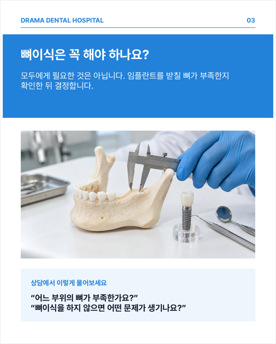 분당임플란트, 빠진 이를 오래 두면 나중에 심기 어려워질까요?