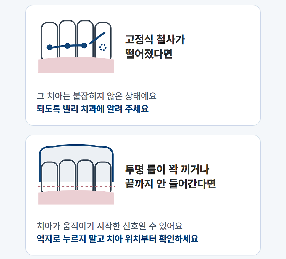 정자동치과, 치아교정이 끝난 뒤 유지장치는 언제까지 껴야 하나요?
