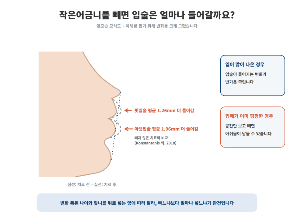 성남치아교정, 교정할 때 어금니를 빼야 하는지는 어떻게 결정되나요?